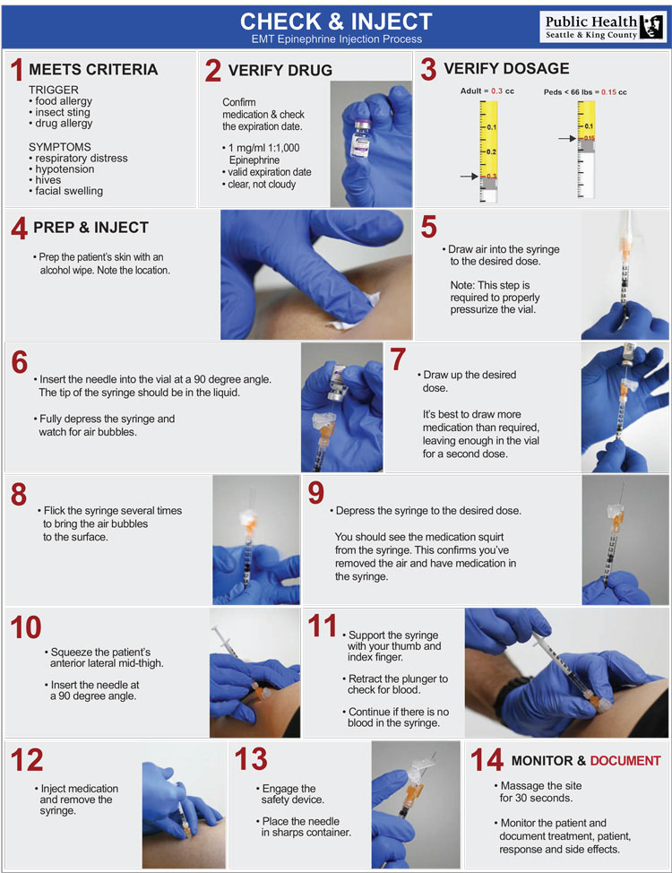 Check and Inject Checklist
