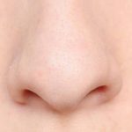 Nose