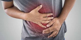 Irritable Bowel Syndrome (IBS)