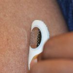 Moonlight Therapeutics Microneedle Patch