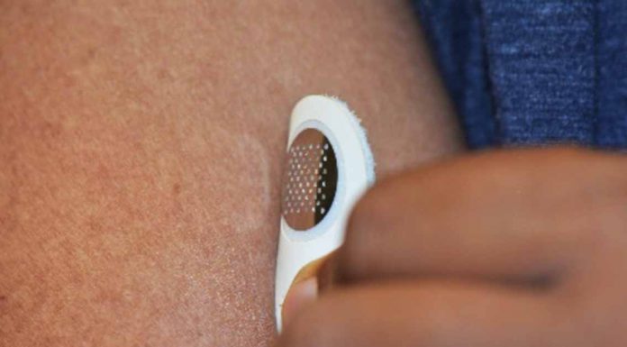 Moonlight Therapeutics Microneedle Patch