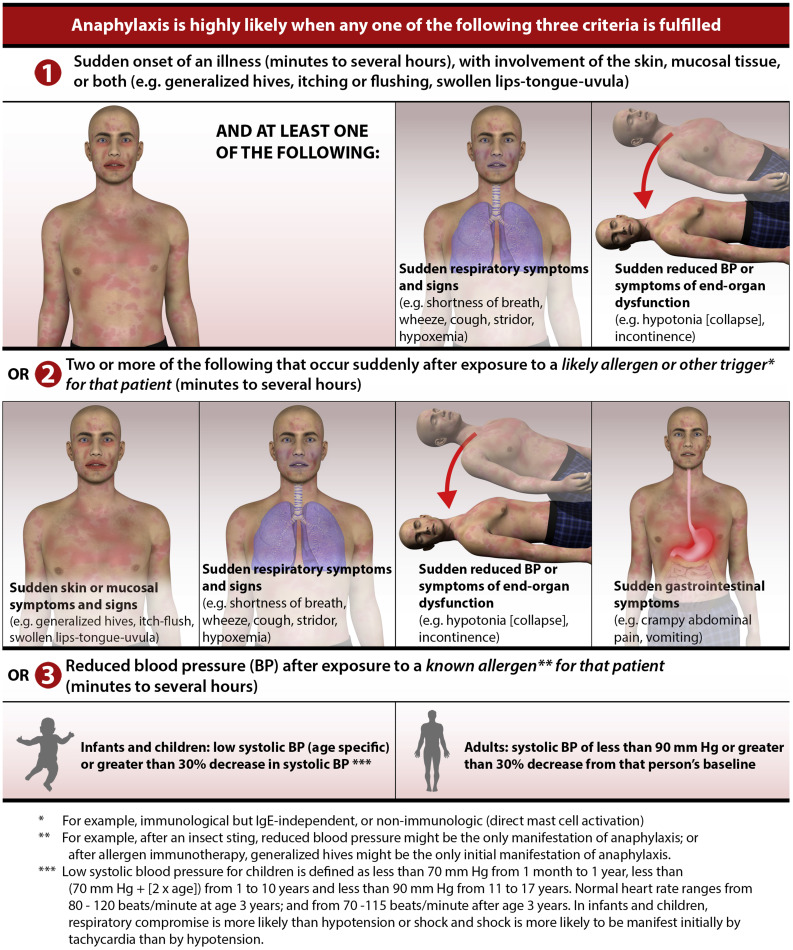Diagnosing Anaphylaxis
