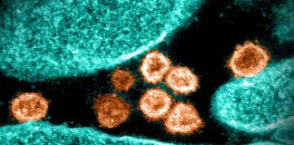 SARS-CoV-2 virus particles emerging from a cell
