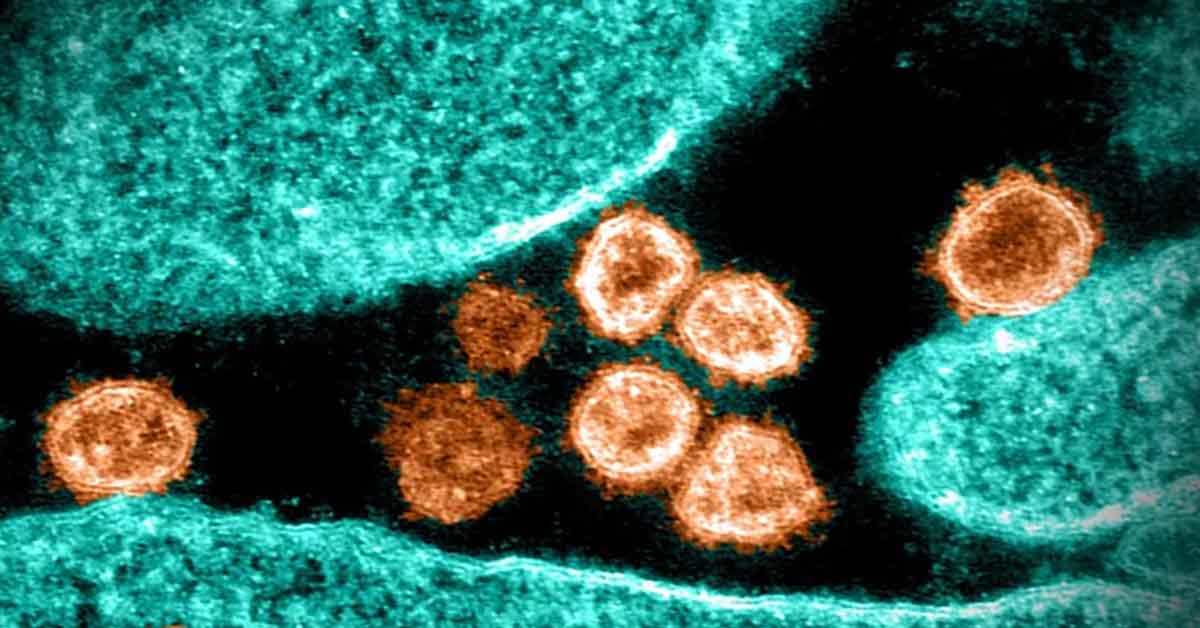 SARS-CoV-2 virus particles emerging from a cell