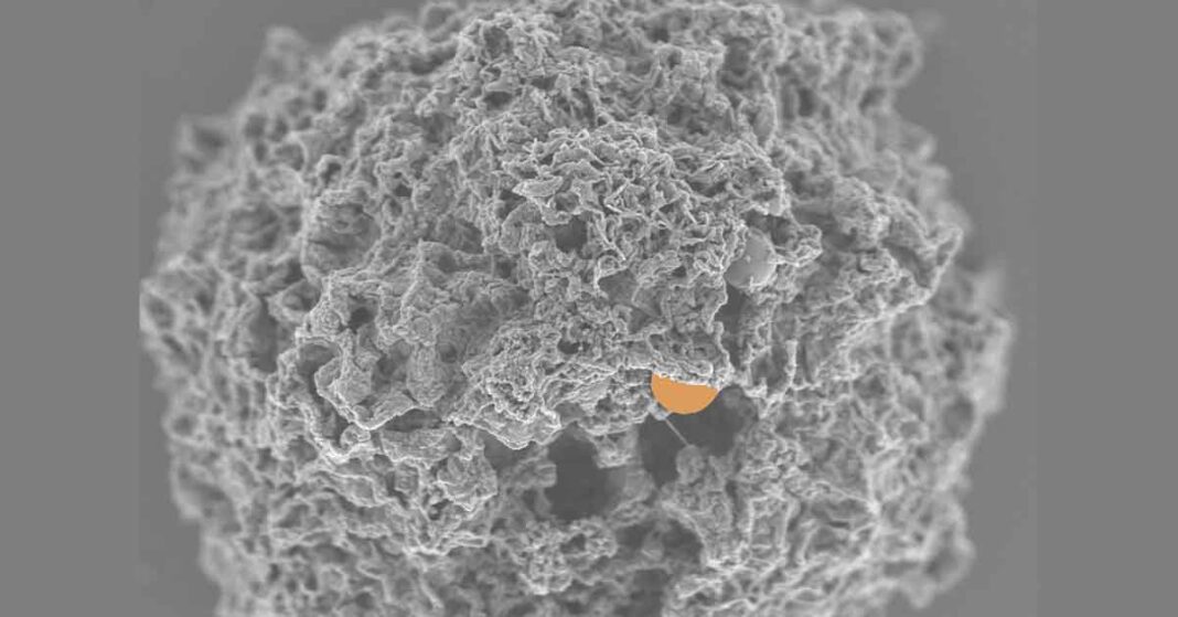 Highlighted Scanning Electron Microscope Image of Nanoparticle Embedded in Mast Cell