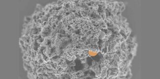 Highlighted Scanning Electron Microscope Image of Nanoparticle Embedded in Mast Cell