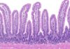 Mouse Intestine Immune Cells