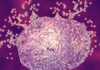 Mast Cell Degranulation