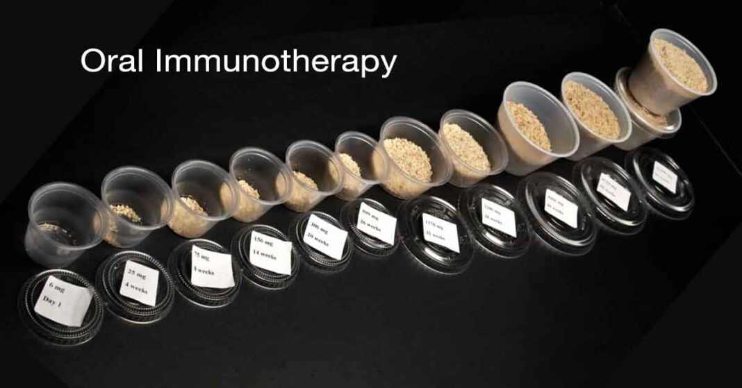 Oral Immunotherapy (OIT)