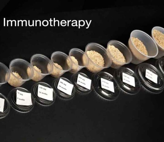 Oral Immunotherapy (OIT)