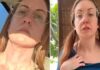 Bee showing a rash after eating a food in the US and showing no rash after eating the same food in Europe.