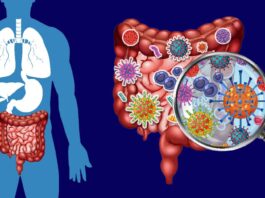 Small Intestine Bacterial Overgrowth (SIBO)