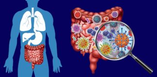 Small Intestine Bacterial Overgrowth (SIBO)