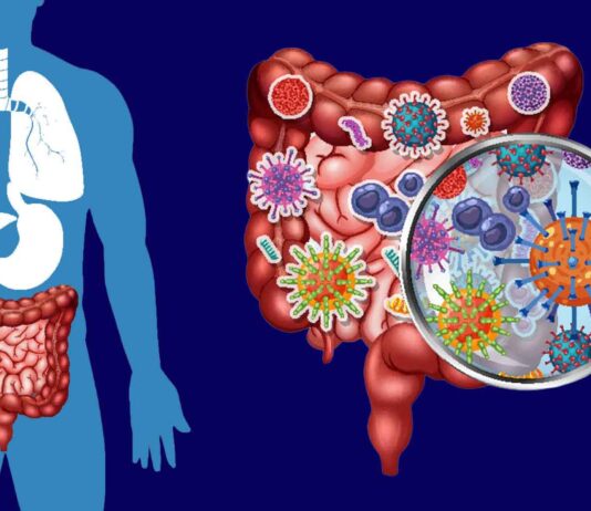 Small Intestine Bacterial Overgrowth (SIBO)