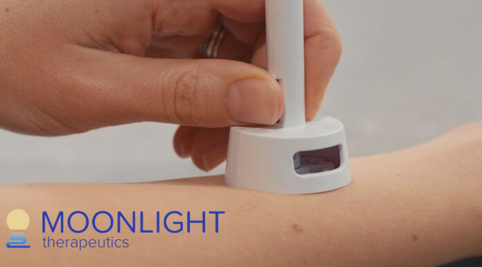 Moonlight Therapeutics Launches First Clinical Trial of Microneedle Peanut Allergy Therapy Administering MOON101