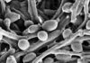 Example of Candida fungus in the gut