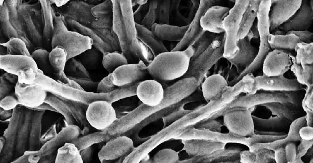 Example of Candida fungus in the gut