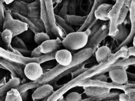 Example of Candida fungus in the gut
