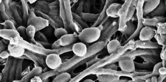 Example of Candida fungus in the gut