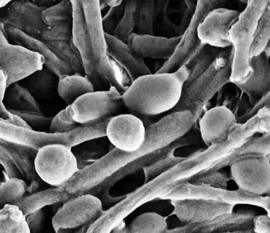 Example of Candida fungus in the gut