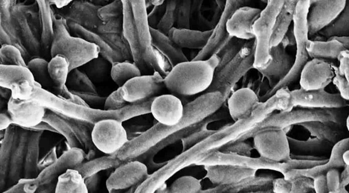 Example of Candida fungus in the gut