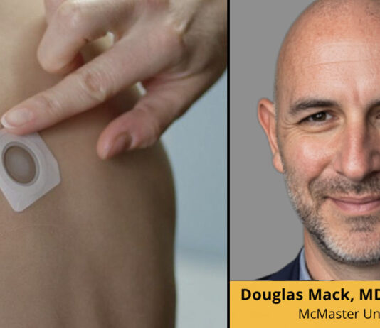 Viaskin Patch and Dr Douglas Mack