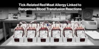 AGS Blood Transfusion Danger - AI-Generated