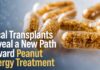 Fecal Transplants Reveal a New Path Toward Peanut Allergy Treatment FMT Peanut Allergy - AI-Generated
