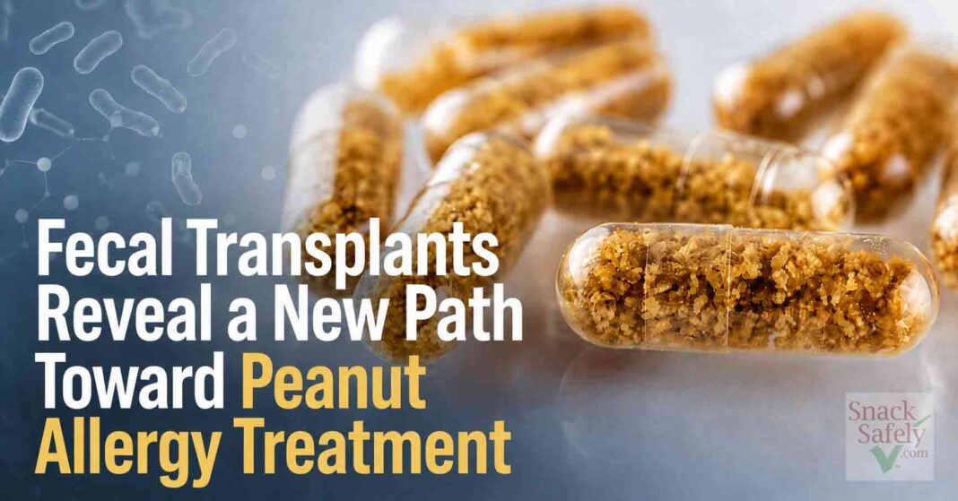 FMT Peanut Allergy - AI-Generated