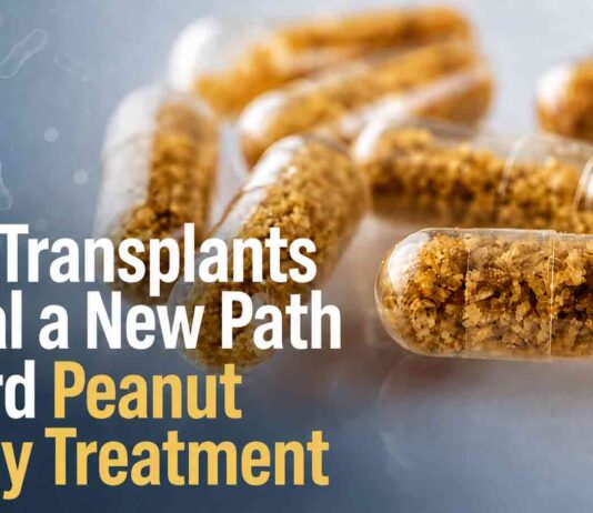 FMT Peanut Allergy - AI-Generated