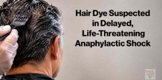 Hair Dye Suspected Anaphylaxis