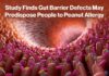 Gut Barrier Defect Peanut Allergy