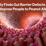 Gut Barrier Defect Peanut Allergy