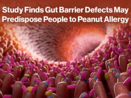 Gut Barrier Defect Peanut Allergy