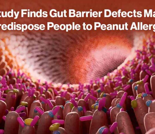 Gut Barrier Defect Peanut Allergy